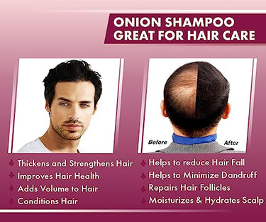 UrbanGabru Natural Onion shampoo for hair strengthening & hairfall control - Paraben & Sulphate free 200gm